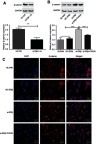 Figure 3 The expression of β-catenin in U2-OS and hFOB1.1 cells detected by Western blot and Immunofluorescence. (A and B) Relative expression of β-catenin at protein level (Western blot); (C) positive stained cells (bar =100 μm, ×100). si-ERβ, U2-OS cells transfected with siRNA-ERβ for 48 hrs; NC-ERβ, U2-OS cells transfected with siRNA-negative control-ERβ for 48 hrs; si-ERβ + FH535, U2-OS cells transfected with siRNA-ERβ and treated with 20 μmol/L FH535 for 48 hrs; blank, U2-OS cells without transfection and treatment. **P<0.01; ***P<0.001.Abbreviations: ERβ, estrogen receptor β; OS, ostemsarcoma; GAPDH, glyceraldehyde-3-phosphate dehydrogenase; DAPI, 4',6-diamidino-2-phenylindole; NC, negative control; si, small interfering RNA.