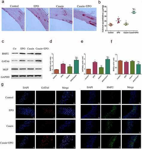 Figure 4. Chronic inflammation aggravated vascular calcification caused by EPO in vivo. Rats were injected intraperitoneally with 2000 U/Kg/W of EPO three times per week or subcutaneously with 10% casein (1.2 g/kg), lasting 20 weeks. A. Alizarin red staining of slices of abdominal aorta (4 μm) and B. calcium deposits quantification and a graph with statistical analysis. C. Western blot results of BMP2, GATA6 and MGP protein expressions. D-F. Densitometric analysis of protein expression. G. Expressions of BMP-2 and GATA6 in the thoracic aorta via immunofluorescence. The results are presented as mean ± SD; n=3. * p<0.05 vs. control group, # p<0.05 vs. EPO group, Δ p<0.05 vs. Casein group.