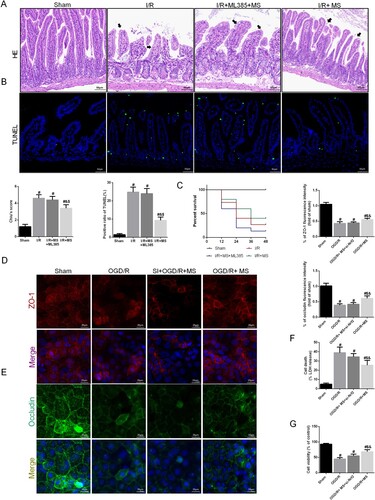 Figure 6. Knockdown of Nrf2 abolished MS-alleviated intestinal I/R injury. The animal models were launched with a 60-min ischemia period as mentioned. MS (10 mL/kg) was used to treat the mice as previously mentioned and ML385, a specific inhibitor of Nrf2, was used as a positive control (n = 10 for each group). (A) Histopathological damage was estimated with H&E staining (scale bars: 100 μm) and Chiu's score. (B) Survival rates were calculated in different groups (n = 15). (C) Representative images of TUNEL staining of intestinal sections (Scale bars: 50 μm). (D) The integrity of the intestinal barrier was evaluated with serum I-FABP levels. Caco-2 cells were transfected with Nrf2-targeting siRNA. Then the OGD/R model was established in Caco-2 cells. (E-F) The expression levels of ZO-1 and Occludin were analyzed by IF staining (Scale bars: 20 μm). (G) The release levels of LDH were detected. (H) Cell viability was measured with a CCK-8 assay. The values are shown as the mean ± SD. #p < 0.05, compared with the sham group, and $p < 0.05 compared with the I/R or OGD/R group, &p < 0.05 compared with the I/R + MS + Nrf2 – / – group.