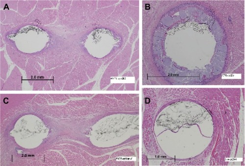 Figure 4 Exemplar histological samples: inflammatory response at the attachment points and middle of the linear component of the implants of sheep at 30 days and 60 days.