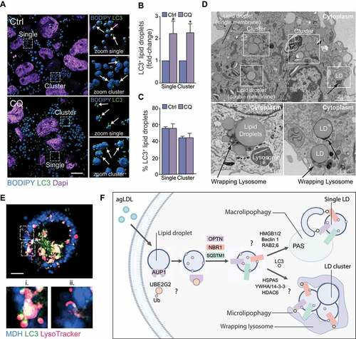 Figure 6. Single lipid droplets (LD) and LD clusters are tagged for lipophagy. (A) 3D Rendering of LC3 (green) localization to LDs stained with BODIPY (blue) in THP-1 macrophages loaded with agLDL and subsequently treated or not with chloroquine (CQ) to inhibit autophagy. Scale bar: 10 μm. (B, C) Quantification of LC3+ LDs found as single LDs or on LDs within a LD cluster in cells shown in (A), expressed as a fold-change in CQ-treated cells relative to untreated (B) or as a percent total LC3+ LDs found as single or clusters of LDs (C). (D) Single and clusters of LDs observed by electron microscopy of murine macrophage foam cells (top panel). Lysosome arm-like extensions can be seen directly engulfing LDs (bottom panels). (E) Micrographs of an agLDL-loaded mouse bone marrow-derived macrophage expressing human GFP-LC3 (green) and labeled with monodansylpentane (MDH) to stain LDs (blue) and LysoTracker Red (magenta). i–ii. Zoom of the regions outlined in the main panel. i) Colocalization of a LD, lysosome and GFP-LC3 puncta. ii) Colocalization of a LD and lysosome. Scale bar: 5 μm. (F) Model of lipophagy mechanisms in mammalian macrophage foam cells, where single LDs or LD clusters are tagged for autophagic degradation, possibly beginning with a AUP1-UBE2G2 complex to initiate ubiquitin tagging of LDs for autophagic degradation. Single LDs may be engulfed by classical macroautophagy beginning with formation of autophagosomes at the phagophore assembly site (PAS) at the periphery or surface of LDs. In this scenario, phagophore maturation may be facilitated by RAB2 and RAB6. Alternatively, clusters of LDs exceeding the size of autophagosomes may be degraded through an aggrephagy-like mechanism mediated by SARs OPTN, NBR1 and SQSTM1 and lipophagy factors HSPA5 along with aggrephagy factors HDAC6 and YWHA/14-3-3 proteins to facilitate microlipophagy