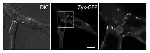 Figure 3. Zyxin accumulates at sites of force-bearing N-cadherin mediated cell-cell junctions in transformed epithelial cells migrating in a 3D matrix. Zyxin-GFP expressing MDCK cells are embedded in a collagen gel, and imaged using a confocal microscope. Zyxin accumulates as focal adhesion-like puncta at cell-cell contacts in a 3D matrix. Scale bar, 10 μm.