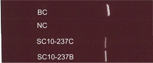 Figure 4 Expression of avian bornavirus (ABV) matrix (M) protein genes in fecal and ureteral urine samples obtained from an ABV-infected military macaw (Ara militaris) based on reverse transcription–polymerase chain reaction analysis.