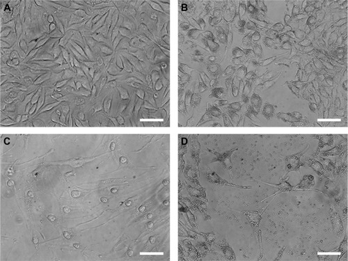Figure 4 Optical microscopy.Notes: Microscopic images of B16F10 cells showing the morphological changes induced by the treatment for 72 hours with PBS (A), ND (200 μg/mL) (B), C (640 μM) (C), and ND + C (200 μg/mL) (D). The white bars indicate 45 μm.Abbreviations: PBS, phosphate-buffered saline; ND, nanodiamond; C, citropten.