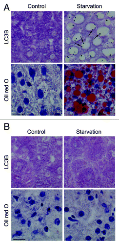 Figure 9. LC3B dots are detectable in frozen liver sections using a staining procedure with alkaline phosphatase and are localized on the surface of lipid droplets. Liver samples were isolated from Atg7+/+ Alb-Cre+ (A) or Atg7F/F Alb-Cre+ mice (B) that were fed normal chow (control) or underwent starvation for 48 h. After fixation in 4% paraformaldehyde, frozen sections were stained for LC3B using biotinylated mouse monoclonal anti-LC3B (clone 5F10, Nanotools, 1:1,000) and Vectastain ABC-AP kit, containing biotinylated alkaline phosphatase instead of biotinylated horseradish peroxidase. LC3B-positive dots (arrows) were detected on the surface of lipid droplets. These structures could be stained using oil red O. Scale bar, 20 μm.