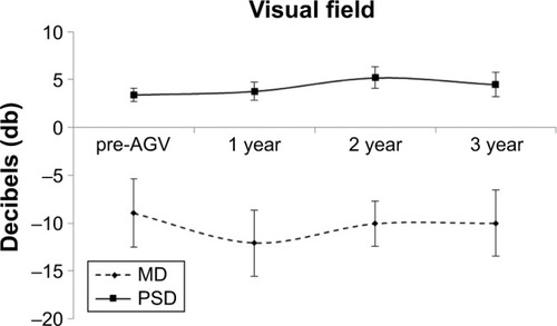 Figure 4 Humphrey Visual Field.