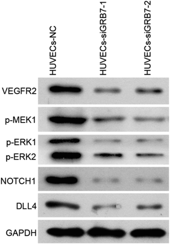 Figure 6. Knockdown of GRB7 in SKOV-3 cells decreases the expression of proteins associated with angiogenesis. HUVECs were seeded in the lower chamber of a transwell insert, and SKOV-3 cells transfected with negative control siRNA (NC) or siRNAs targeting GRB7 (siGRB7-1 or siGRB7-2) were seeded in the upper chamber of the transwell insert. These conditions are designated as HUVECs-NC, HUVECs-siGRB7-1, and HUVECs-siGRB7-2. After co-culture for 24 h, HUVECs were harvested for western blotting to measure the expression of VEGFR2, p-MEK1, p-ERK1/2, NOTCH1, and DLL4