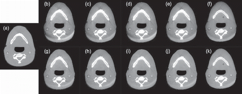 Figure 8. Reconstructed anthropomorphic head phantom images from (a) CT, (b)–(f) CBCT OBI, and (g)–(k) CBCT FFE (level =100 HU, window = 600 HU). From left to right the CBCT stem from SDH, SDHFS, HQH, HQHFS and OBI13FS reconstructions, respectively.