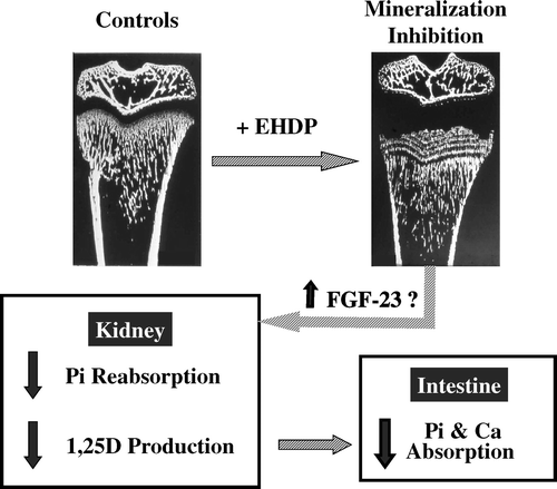 Fig. 5. Experimental setting at the origin of the bone-kidney link concept in Pi homeostasis. Treatment of rats with the bisphosphonate EHDP (10 mg P equivalent per kg.day−1 subcutaneously for 7 days) resulted in a blockage of bone mineralization. This restraint in the capacity of the bone organic matrix to incorporate Pi and Ca was followed at the kidney level by a selective inhibition of both the tubular Pi reabsorption and 1,25D production. As consequences of this transport and endocrine renal effects, the circulating level of Pi and 1,25D decreased. This latter effect led to a reduction in the intestinal absorption of both Ca and Pi. As discussed further in the text, FGF-23 may well be the factor involved in the kidney response observed after EHDP-induced inhibition of bone mineralization. Microradiographs reprinted from Schenk et al. [Citation44]. EHDP = ethane-1-hydroxy-1, 1-bisphosphonate.