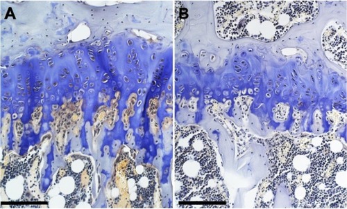 Figure 2 Micrographs of the proximal tibial growth plate of (A) control and (B) genistein-fed ob/ob mice.