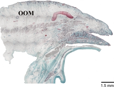 Figure 2 Microscopical sanple (left: lateral, up: anterior). The orbicularis oculi muscle continuously situated and the lateral palpebral raphe is not identified.