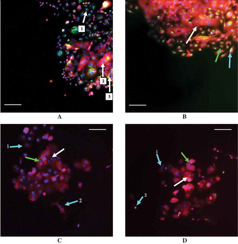 Figure 6. Examples of staining in the MCF7 and SW480 cell lines with E-cadherin staining in red and vimentin staining in green. (a) 30% confluent SW40 cells with 0 ng/mL TGF-β while (b) is 30% confluent SW480 cells with 9.33 ng/mL TGF-β. (c) 30% confluent MCF7 cells with 0 ng/mL TGF-β while (d) is 30% confluent MCF7 cells with 9.33 ng/mL TGF-β. Arrows are color coordinated: blue arrows indicate a cell with a low number of neighbors, green indicates cells with a medium number of neighbors, and white indicates cells with a high number of neighbors, as determined using a threshold distance of the average nuclei distance +1 standard deviation. A scale bar of 100 μm is shown in each image. (a) Arrows 1, 2, and 3 all indicate three different SW480 cells that were classified as having a high number of neighbors that all stained differently: cell 1 has stained solely for vimentin, cell 2 for E-cadherin only, and cell 3 has stained for both vimentin and E-cadherin simultaneously. (b) The SW480 30% confluent +9.33 ng/mL TGF-β treatment group and cells that are classified as having different neighbor numbers all staining dually for E-cadherin and vimentin. (c) The cell at arrow 1 has a low neighbor number and has stained faintly for E-cadherin while the cell at arrow 2 also has a low neighbor number and has stained slightly more for E-cadherin, despite the fact that it is beginning to adopt a spindle-like phenotype. Additionally, E-cadherin is also expressed in the cells at the green arrow and the white arrow, which have a medium number of neighbors and a high number of neighbors, respectively. (d) With the addition of 9.33 ng/mL exogenous TGF-β, MCF7 cells with a medium (green arrow) and high (white arrow) neighbor number are positively stained for E-cadherin. Arrow 1 indicates a cell with a low neighbor number that has not stained for either E-cadherin or vimentin, or possibly faintly stained for E-cadherin, while arrow 2 points to a cell that also has a low neighbor number that has positively stained for vimentin.