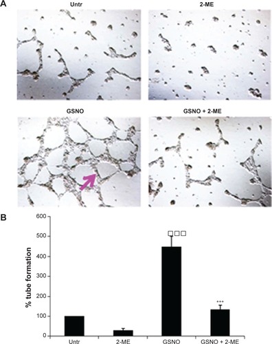 Figure 6 Effect of GSNO on formation of capillary-like proangiogenic structures on endothelial cells.