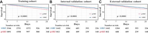 Figure 2 Survival analyses comparing between persistent and transient acute kidney injury patients in the training cohort (A), internal validation cohort (B) and external validation cohort (C).