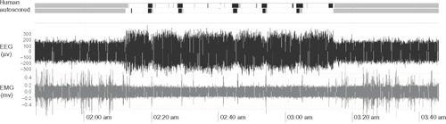 Figure 2 EEG and EMG data for comparison of human scoring and machine scoring.