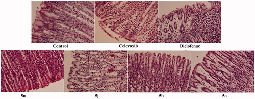 Figure 4. The ulcerogenic effect of the tested compounds 5 b, 5j, 5n and 5o as well as celecoxib and Diclofenac as reference drugs on gastric layers.