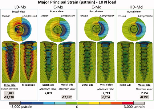 Figure 5. Major principal strain distribution (µstrain) distribution for the four FE models under 10 N: low-dense maxilla (LD-Mx), control maxilla (C-Mx), control mandible (C-Md), and high-dense mandible (HD-Md).