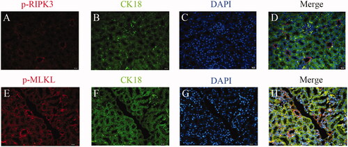 Figure 5. Co-location analysis of key necroptosis molecules in kidney of TCE-sensitized mice. (A) p-RIPK3 staining as Red, (B) CK18 staining as marker of renal tubular epithelial cells, (C) DAPI staining as blue. (D) Overlap of A–C. (E) p-MLKL staining as Red, (F) CK18 staining as marker of renal tubular epithelial cells, (G) DAPI staining as blue. (H) Overlap of E–G. Magnification 400×. Scale bars = 50 μm.