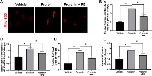 Figure 5 Delivery of exogenous PE ameliorates prorenin-induced oxidative/nitrosative stress in microglia. (A and B) Representative graph indicates fluorescent probe staining and intensity values quantification of mitoROS. Scale bar = 4 μm. (C) The GSSG/GSH ratio was detected using GSH and GSSG Assay Kit. The results indicate exogenous PE delivery attenuates prorenin-induced GSSG/GSH ratio increase in cultured microglia. (D) The level of nitrosative indicator 3-NT quantified using nitrotyrosine ELISA Kit. The results suggest delivery of PE ameliorates prorenin-induced nitrosative stress in cultured microglia. (E) The lipid peroxidation was measured using MDA kits. The data imply PE supplement alleviates lipid peroxidation in prorenin stimulated-microglia. Data are presented as the mean ± SD. n = 3–5, *p < 0.05, #p < 0.05, t-test.