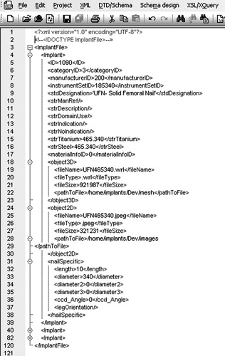 Figure 5. Example of an implant XML file.