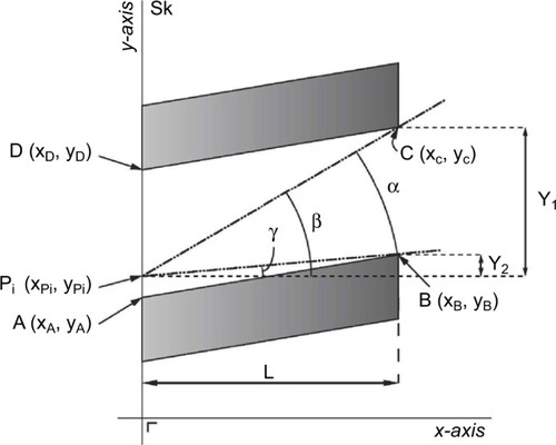 Figure 2 Two adjacent spinous processes are depicted (shaded areas).