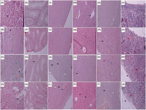 Figure 9. Histopathology of kidney, testis, brain, liver, heart, and spleen in mice treated with biogenic Zn NPs at two doses of 1 and 5 g/kg and ZnSO4 at the dose of 100 mg/kg for 14 consecutive days (H & E stain with × 100 magnifications). Control group: no pathologic changes were observed in normal glomeruli (black arrow) and tubules. (A), kidney of mouse treated with Zn NPs at dose of 1 g/kg group showed mild congestion (black arrow), mild focally mononuclear cell infiltration (orange arrow) and intratubular protein deposition (blue arrows) (B); kidney of mouse treated with Zn NPs at dose of 5 g/kg group showed congestion and dilatation of vessels (black arrow), congestion of glomeruli (green arrow), mononuclear cell infiltration (orange arrows) and intratubular protein deposition (bluish arrows) (C), kidney of mouse treated with ZnSO4 at the dose of 100 mg/kg group showed congestion and dilatation of vessels (black arrow), focally mild mononuclear cell infiltration (orange arrows) and intratubular protein deposition (blue arrows) (D). Control group: normal appearance (closely packed seminiferous tubules) (E), testis of mouse treated with Zn NPs at dose of 1 g/kg group showed closely packed seminiferous tubules, mild congestion and dilatation (red arrows) (F); testis of mouse treated with Zn NPs at dose of 5 g/kg group showed necrotic mature and immature spermatocytes (black arrow) and many abnormal-appearing residual bodies (blue arrows) (they are larger than normal residual bodies and often occur in tubular stages not normally associated with residual body formation) (G), testis of mouse treated with ZnSO4 at the dose of 100 mg/kg group showed mild to moderate tubular injury, sloughing and disorganization with interstitial edema (increased spaces between the tubules) (H). Control group: normal histopathology in brain cortex tissue (I), Brain cortex of mouse treated with Zn NPs at dose of 1 g/kg group was changed the same as control (J); the cerebral cortex at dose of 5 g/kg of Zn NRs showed mild edema (spongiosis), vascular congestion, neuronal vacuolization, some cellular injuries as red degeneration with pyknotic nuclei and eosinophilic cytoplasm and also the proliferation of reactive astrocytes (gliosis) (K), brain cortex of mouse treated with ZnSO4 at the dose of 100 mg/kg group showed moderate edema (spongiosis), the proliferation of reactive astrocytes (gliosis), marked cellular injuries as red degeneration with pyknotic nuclei and eosinophilic cytoplasm, vascular congestion and extravasation of RBC (L). Control group: no histopathologic changes with normal architecture, central vein (black arrows) and portal tract (orange arrow) (M), liver of mouse treated with Zn NPs at dose of 1 g/kg group showed central vein congestion (blackish arrow), and focally mild lobular inflammation (bluish arrow) (N); liver of mouse treated with Zn NPs at dose of 5 g/kg group showed central vein congestion (black arrow), and focal lobular inflammation (orange arrows) (O); liver of mouse treated with ZnSO4 at the dose of 100 mg/kg group showed sinusoidal congestion, cholestasis (red arrows) and kupffer cell proliferation (orange arrows) with increased binucleated hepatocytes (blackish arrow) (P). Control group: no pathological changes (Q), heart of mouse treated with Zn NPs at dose of 1 g/kg group showed mild congestion (black arrow) and mild edema (orange arrow)(R); heart of mouse treated with Zn NPs at dose of 5 g/kg group showed edema (orange arrow), some vacuolization of myocytes (blue arrows), mononuclear cells infiltration (whitish arrow), myocardial damage as presence of hypereosinophilic cardiomyocytes (reddish arrow) (S), heart of mouse treated with ZnSO4 at the dose of 100 mg/kg group showed some vacuolization of myocytes, congestion (black arrow), edema (orange), mononuclear cell infiltration (whitish arrow) and hemorrhage (green arrow) (T). Control group: no pathological changes with some megakaryocytes (red arrows) (U), spleen of mouse treated with Zn NPs at dose of 1 g/kg group showed congestion of red pulp and mild increase of megakaryocytes (red arrows) (V); spleen of mouse treated with Zn NPs at dose of 5 g/kg group showed mild thickening of the capsule, trabecula (black arrow), congestion of red pulp, dense basophilia of the cortex (cluster of lymphocytes other than white pulp) and mild increased megakaryocytes (red arrows) (W), spleen of mouse treated with ZnSO4 at the dose of 100 mg/kg group showed thickening of the capsule and trabecula (black arrow), with dense basophilia of the cortex (cluster of lymphocyte other than white pulp) and mild increased megakaryocytes (red arrows) less than Zn NPs at the dose of 5 g/kg group (X).