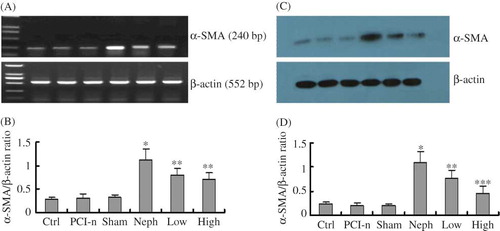 Figure 8.  HGF mitigates renal injury induced α-SMA expression. (A) RT-PCR analysis of α-SMA mRNA level in different renal tissues. (B) Densitometric analysis of α-SMA mRNA normalized to β-actin. (C) A representative Western blot of α-SMA protein level in different renal tissues. (D) Densitometric analysis of α-SMA protein normalized to β-actin. Ctrl, control group; PCI-n, PCI-neo group; Sham, sham-operation group; Neph, 5/6 nephrectomy group; Low, low-dose PCI-neo-HGF group; High, high-dose PCI-neo-HGF group. *p < 0.05 versus Ctrl group; **p < 0.05, ***p < 0.01 versus Neph group.