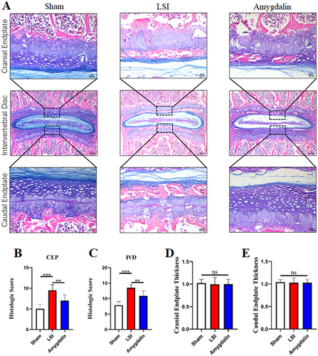 Figure 4 AMD attenuated cartilaginous endplate calcification in LSI mice. (A) Alcian Blue Hematoxylin/Orange G staining of cranial L4–L5 endplate (top panels, high magnification), caudal L4–L5 endplate (bottom panels, high magnification), and the whole L4–L5 IVD (middle panels, low magnification) at 12 weeks after operations. (B and C) Quantitative analysis of L4–L5 endplate score and IVD score at 12 weeks post-operation. (D and E) Quantitative analyses of cranial or caudal L4–L5 endplate thickness. Data were presented as means ± S.D. **P < 0.01; ***P < 0.001; ns: significant difference, n = 6 in each group.