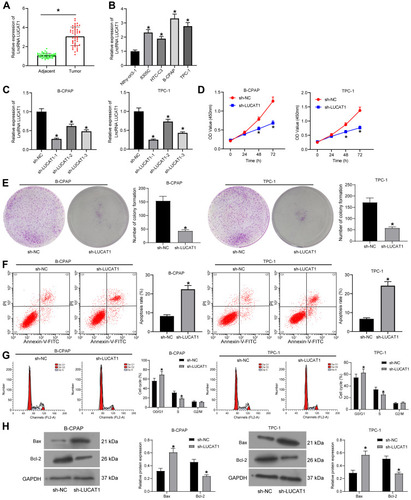 Figure 1 Silencing of LNCAT1 inhibits proliferation but promotes apoptosis of TC cells. (A) Expression of lncRNA LUCAT1 in tumor and normal tissues determined by RT-qPCR; (B) LUCAT1 expression in TC cell lines (8305C, HTC-C3, B-CPAP and TPC-1) and in Nthy-ori3-1 cells determined by RT-qPCR; (C),expression of LUCAT1 in B-CPAP and TPC-1 cells after sh-LUCAT1 transfection determined by RT-qPCR; (D) proliferation of B-CPAP and TPC-1 cells determined by CCK-8 method; (E) colony formation ability of B-CPAP and TPC-1 cells measured by colony formation assay (×100); (F) apoptosis rate of cells determined by flow cytometry; (G) cell cycle distribution in cells determined by flow cytometry; (H) protein levels of Bax and Bcl-2 in cells determined by Western blot analysis. Data were expressed as mean ± SD from three repeated experiments. Data were analyzed by paired t-test (A), unpaired t-test (E and F), and one-way (B and C) or two-way ANOVA (D, G and H). *p < 0.05, compared to adjacent samples, Nthy-ori3-1 or sh-NC.