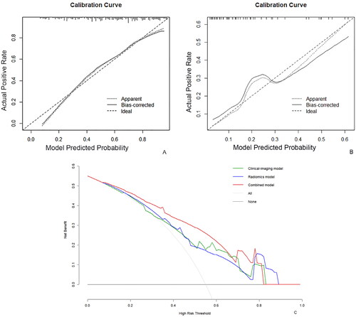 Figure 6. Evaluation and verification of the combined model. (A, B) calibration curves for the combined model regarding the agreement between predicted and actual reintervention risk in training (A) and validation (B) cohort. The x-axis represents the probability predicted by the combined model, and the y-axis represents the actual probability. The perfect prediction corresponds to the thick black dashed line. The thin black dashed line indicates the entire cohort, and the solid black line is bias-corrected by bootstrapping (1000 repetitions), showing the observed combined model performance. (C) Decision curve analysis for the combined model. The thick black line represents the net benefit of assuming no fibroid patients receive HIFU ablation. The thin black line is the net benefit of taking that all fibroid patients receive HIFU ablation. The green, blue and red lines represent the expected net benefit of predicting the risk of reintervention using the clinical-imaging, radiomics and combined models.