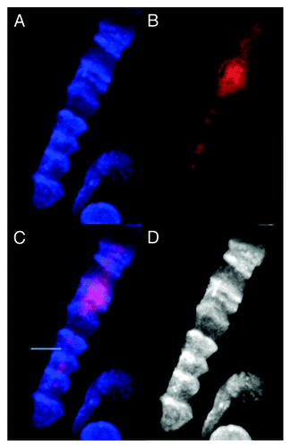 Figure 4. Images of dsDNA (DAPI, blue) and dsRNA/DNA (TRITC-Ab, red) stain in metakaryotic syncytial nuclei undergoing synchronous symmetrical amitoses in fetal spinal cord, 10 wks. (A) DAPI fluorescence (blue). (B) TRITC-Ab fluorescence (red). (C) Merged images of (A) and (B) showing nuclei labeled simultaneously with DAPI and TRITC-Ab. (D) Achromatic image of (A). Image by Koledova VV.