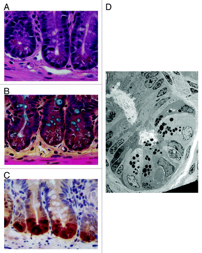 Figure 1. Microscopic evaluation of mouse Paneth cells. (A) Hematoxylin and eosin (640×) staining of small intestinal tissue reveals Paneth cell secretory granules by their eosinophilic coloration. (B) Alternatively, these subcellular structures can be discerned by phloxine-tartrazine staining (640 × ). In this image, goblet cells are co-visualized using Alcian Blue. (C) Immunohistochemical recognition of epithelial-specific expression of Paneth cell products, such as lysozyme, can also be used to visualize Paneth cells (640×). (D) Transmission electron micrograph of the fine structure of Paneth cells is aided by the electron-dense nature of the Paneth cell secretory granules. Scale bar is 5 μm. Images in panels (B-C) provided by Dekaney C, UNC.
