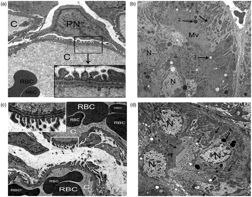 Figure 5. Electron micrographic ultrathin sections of renal cortex. (a,b): Sections obtained from kidney of sodium selenite pretreated group, (a): shows many capillary loops (c), PN: podocytic nucleus, RBC: red blood corpuscle. Lower right rectangle showing: 1-BM, 2-endothelium fenstrations, P2: secondary foot processes. (O.M. X10,000 & X25,000), (b): shows part of the PCT. 1-mitochondria, 2-lysosome, 3-vaculoes, N: nucleus of tubular epithelial cell, Mv: microvilli (X5000). (c,d): Sections obtained from kidney of taurine pretreated group, (c): shows many capillary loops, RBC: red blood corpuscle. Upper left rectangle showing: 1-fenstration of endothelium, 2-BM, P2: secondary foot processes (X10,000 & X25,000) and (d): shows part of PCT: 1-microvilli, 2-vacuole, 3-normal mitochondria, 4-lysosome, 5-swollen mitochondria (X6000).