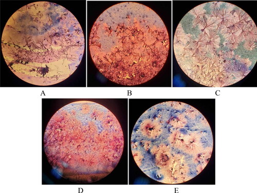 Figure 3. Microscopic pictures of Escherichia coli (А-E). after initial cultures of the strains from the lyophilized form stored for four to five decades. Slides were prepared by Gram staining and were observed under immersion system, 100x (Carl Zeiss Microscopy GmbH, Primo star).Note: E. coli strains O7 (A), O11 (B), O25 (C), O111 (D) and O125 (E).