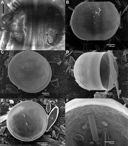 Figure 7  Light and scanning electron micrographs of a globular initial cell of Cavernosa kapitiana from Ile de la Possession. A, LM view of complete initial cell. B, SEM view of a complete initial cell. C,D, SEM view of external surface structure of an initial valve. A small ringleiste is visible on (D). E, SEM internal view of an initial valve with the presence of two rimoportulae and only weakly developed caverns. F, SEM detail of the internal surface structure showing an irregular pattern of areolae openings and two rimportulae. Scale bars, 10 μm except for (F), 5 μm.