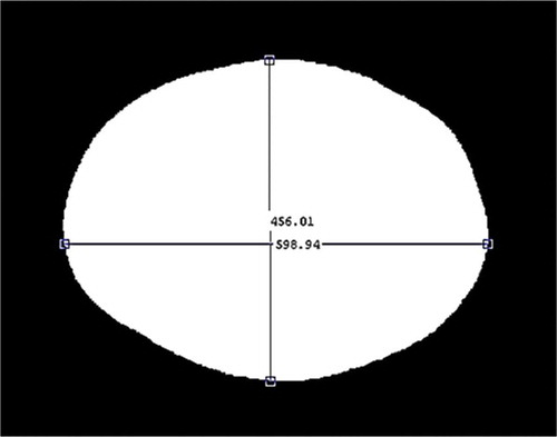 FIGURE 5 Length and width of a sample potato extracted from binary image.