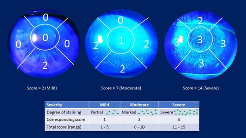 Figure 4 Corneal fluorescein staining score.