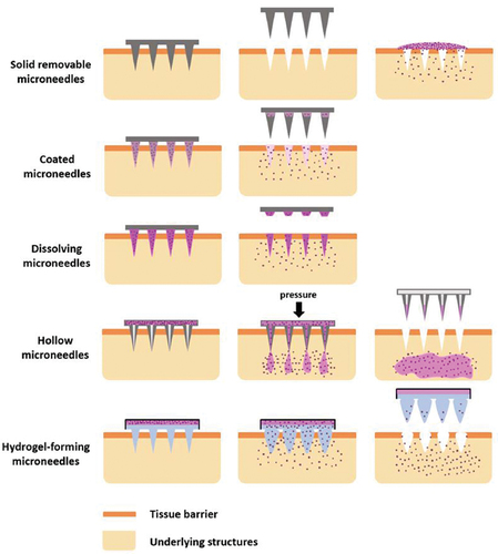 Figure 1. Types of MNs, step-by-step process of their application, and corresponding mechanisms of drug delivery across a tissue barrier (reproduced from [Citation23]).
