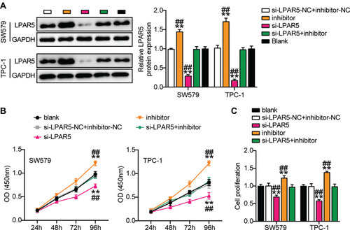 Figure 8 MiR-513c-5p inhibits proliferation of THCA cells through LPAR5. (A) The protein expression level of LPAR5 were measured by Western blot in SW579 and TPC-1 cells transfected with si-LPARS or miR-513c-5p inhibitor. (B) Viability of SW579 and TPC-1 cells with si-LPARS or miR-513c-5p inhibitor transfection were detected by CCK-8 assay. (C) Proliferation of SW579 and TPC-1 cells with si-LPARS or miR-513c-5p inhibitor transfection were detected by BrdU assay. si-LPARS, silencing LPARS. Inhibitor, miR-513c-5p inhibitor. NC, co-transfected with si-LPARS-NC and inhibitor-NC. **P < 0.001 vs blank; ## P < 0.001 vs si-LPAR5+inhibitor.
