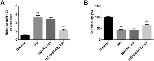 Figure 1. miR-122 knockdown enhanced cell viability of high glucose-induced ARPE-19 cells (A) qRT-PCR was used to determine the expression of miR-122 in ARPE-19 cells treated with high glucose and transfected with the miR-122 inhibitor (B) The cell viability of ARPE-19 cells treated with high glucose and transfected with miR-122 inhibitor was measured by MTT assay. **: p < 0.01. ##: p < 0.01.