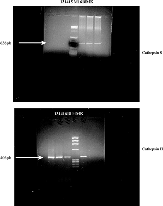 Figure 1 Image of the gel with the gene products concerning the embryonic kidneys at the gestational ages of 13, 14, 15, 16, and 18 days, and the kidneys of the mother (MK). The “M” line refers to the digested plasmid used as a marker.