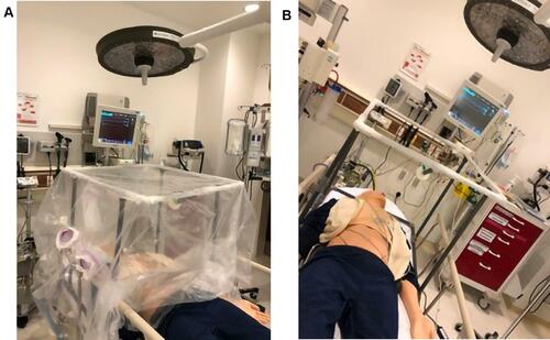 Figure 1 The utilized aerosol box at our institution with (A) and without (B) a transparent plastic disposable sheet.