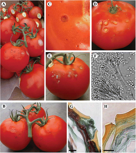 Fig. 1. Symptoms of spotting observed on tomato fruit collected from the packinghouse of a commercial greenhouse in the Fraser Valley of BC. (A–C) Black spots can be seen 2–3 days after harvest, and progress to yellow (D) or grey (E) lesions after 7–10 days in storage. (F). Penicillium-like conidiophores visible on clear tape lifts taken from sporulating lesions. (G) Hyphae and necrosis associated with cuticle cracks from black spots compared with cuticle cracks of healthy tissues (H) (400 × magnification, bar = 20 μm).