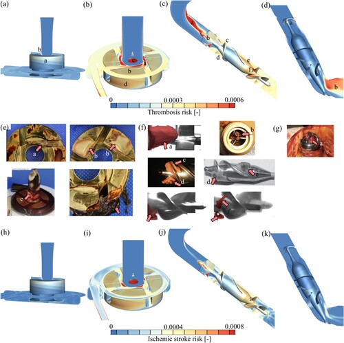 Figure 9. Blood pump-induced thrombosis and ischemic stroke high-risk regions assessed: (a) HeartMate 3 blood pump-induced thrombosis risk regions prediction and validation; (b) HeartWare blood pump-induced thrombosis risk regions prediction and validation; (c) HeartMate II blood pump-induced thrombosis risk regions prediction and validation; (d) Jarvik 2000 blood pump-induced thrombosis risk regions prediction and validation; (e) HeartWare blood pump-induced thrombosis risk regions validation; (f) HeartMate II blood pump-induced thrombosis risk regions validation; (g) Jarvik 2000 blood pump-induced thrombosis risk regions validation; (h) HeartMate 3 blood pump-induced ischemic stroke risk regions; (i) HeartWare blood pump-induced ischemic stroke risk regions; (j) HeartMate II blood pump-induced ischemic stroke risk regions; and (k) Jarvik 2000 blood pump-induced ischemic stroke risk regions.