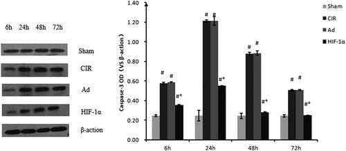 Figure 6. Relative quantification of caspase-3 protein expression using western blot analysis at different reperfusion time points. Western blot analysis was used to detect the protein expression of caspase-3. Data were obtained by densitometry and normalized using β-actin as a loading control. Data are presented as mean ± SD. *p < 0.01 vs. CIR and Ad groups, #p < 0.01 vs. normal and sham groups.