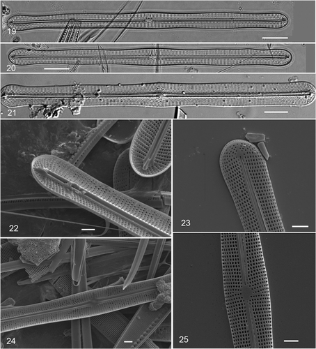 Figs 19–25. Climaconeis undulata acid-cleaned valves. Figs 19–20. Two valves showing radiating stria pattern; field-collected material (GU16V), DIC. Fig. 21. Valve of Navicula scopulorum var. triundulata; slide N11/17 in Hustedt collection, prepared by Hustedt from Meister's material, photo H52078-3a courtesy of AWI (Citation2009) (DIC). Figs 22–25. SEM of cultured cells. Fig. 22. Internal apex showing helictoglossa. Fig. 23. External apex. Fig. 24. Internal central area. Fig. 25. External central area. Scale bars: Fig. 19–21, 10 µm; 22–25 = 2 µm.