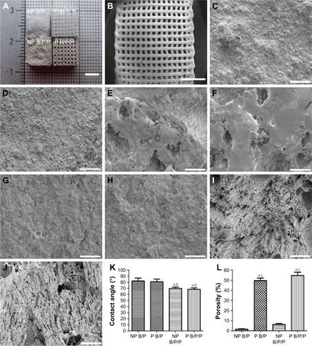 Figure 2 Macroscopic and microscopic structures, hydrophobicity, and porosity of the scaffolds.Notes: Gross appearance of the following four types of scaffold: NP B/P scaffolds, P B/P scaffolds, NP B/P/P scaffolds, and P B/P/P scaffolds (A). The P B/P/P scaffolds had a higher porosity and higher connectivity rate (B); scale bar: 5 mm. Scanning electron microscopy observations of the surface morphology of NP B/P scaffolds (C), P B/P scaffolds (D), NP B/P/P scaffolds (E), and P B/P/P scaffolds (F). Scanning electron microscopy observations of the internal microstructure of NP B/P scaffolds (G), P B/P scaffolds (H), NP B/P/P scaffolds (I), and P B/P/P scaffolds (J); scale bars: 50 μm. (K) Water contact angle determination. (L) Porosity measurements. Results are mean ± standard deviation (χ ± SD), n=6; αP<0.05 vs NP B/P scaffolds; βP<0.05 vs P B/P scaffolds; γP<0.05 vs NP B/P/P scaffolds.Abbreviations: NP B/P, nonprinted biphasic calcium phosphate/polyvinyl alcohol; NP B/P/P, nonprinted biphasic calcium phosphate/polyvinyl alcohol/platelet-rich fibrin; P B/P, printed biphasic calcium phosphate/polyvinyl alcohol; P B/P/P, printed biphasic calcium phosphate/polyvinyl alcohol/platelet-rich fibrin.