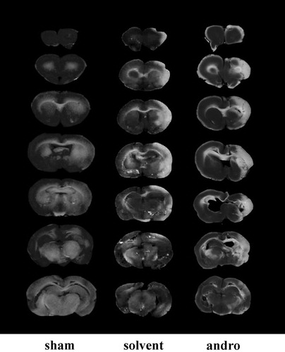 Figure 4. Effects of andrographolide (andro) on middle cerebral artery occlusion (MCAO)/reperfusion-induced brain injury in rats. Coronal sections of brains were stained by TTC in rats at 24 h after MACO-reperfusion. Cerebral infarction in sham-operated (sham) or MACO-reperfusion rats is from a representative animal that received solvent (DMSO) or andrographolide (5 mg/kg) intraperitoneally.