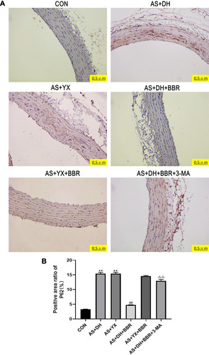 Figure 5 P62 protein expression in the rat aortic tissues. (A) Immunohistochemical detection P62 (200×). (B) P62 protein-positive area ratio.