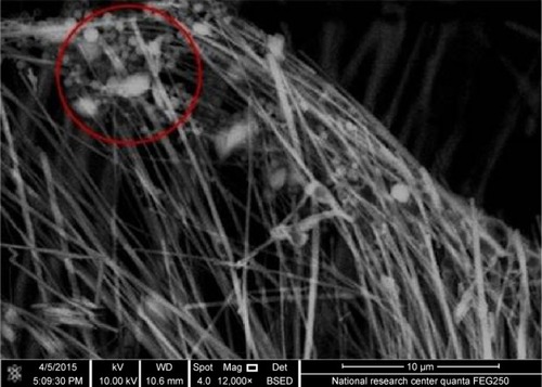 Figure 5 Scanning electron micrograph of freeze-dried nanosuspension showing dispersed spherical nanoparticles inside a crystalline matrix of cryoprotectant (red circle).